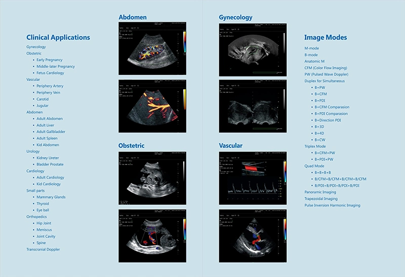 3D 4D Trolley Color Doppler Ultrasound Scanner (AM- G60)