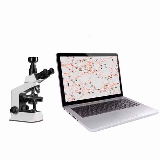 Equipamento clínico de detecção de sêmen, analisador de qualidade de esperma de semenologia